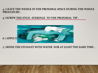 4 ) LEAVE THE WEDGE IN THE PROXIMAL SPACE DURING THE WHOLE
PROCEDURE .
5 ) SCREW THE ETCH –SYERINGE TO THE PROXIMAL TIP .
6 ) APPLY ETCH MATERIAL FOR (2) MIN .
7 ) RINSE THE ETCHANT WITH WATER FOR AT LEAST THE SAME TIME .
 