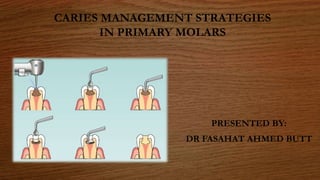 CARIES MANAGEMENT STRATEGIES
IN PRIMARY MOLARS
PRESENTED BY:
DR FASAHAT AHMED BUTT
 
