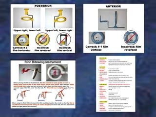 Setting Up Rinn Instruments Caries and Periodontal Localization.ppt