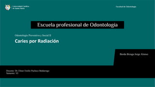Docente: Dr. Elmer Emilio Pacheco Baldarrago
Semestre: VI
Borda Bizaga Jorge Alonso
Odontología Preventiva y Social II
Caries por Radiación
 