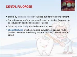 DENTAL FLUOROSIS
• occurs by excessive intake of fluoride during tooth development.
• Once the crowns of the teeth are formed no further fluorosis can
be induced by additional intake of fluoride
• Occurs symmetrically within the dental arches.
• Clinical features are characterized by lusterless opaque white
patches in enamel which may become mottled, striated and/or
pitted
 