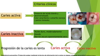 Caries activa
Caries inactiva
Criterios clínicos
Presencia de tejido blando y
desmineralizado.
Color amarillento o amarillo naranja
( parece húmedo)
Tejido duro, moderadamente
blando
Marrón oscuro aparentemente seco
Progresión de la caries es lenta Caries activa Caries inactiva
Endodoncia preventiva: Protección pulpar mediante la técnica de eliminación de la caries en etapas (stepwise excavation) Castellanos-Cosano L
 
