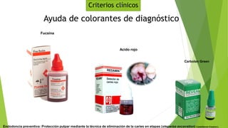 Ayuda de colorantes de diagnóstico
Fucsina
Acido rojo
Carbolan Green
Criterios clínicos
Endodoncia preventiva: Protección pulpar mediante la técnica de eliminación de la caries en etapas (stepwise excavation) Castellanos-Cosano L
 