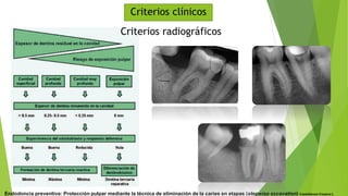 Criterios radiográficos
Criterios clínicos
Endodoncia preventiva: Protección pulpar mediante la técnica de eliminación de la caries en etapas (stepwise excavation) Castellanos-Cosano L
 