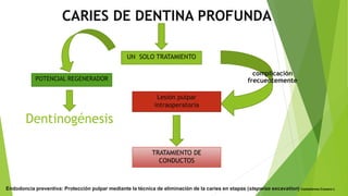 CARIES DE DENTINA PROFUNDA
UN SOLO TRATAMIENTO
POTENCIAL REGENERADOR
TRATAMIENTO DE
CONDUCTOS
Endodoncia preventiva: Protección pulpar mediante la técnica de eliminación de la caries en etapas (stepwise excavation) Castellanos-Cosano L
Lesión pulpar
intraoperatoria
Dentinogénesis
complicación
frecuentemente
 