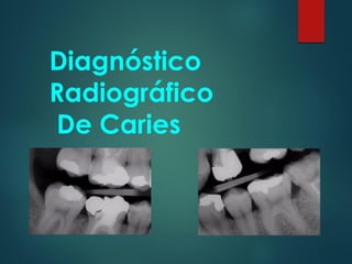 Diagnóstico
Radiográfico
De Caries
 