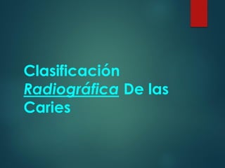 Clasificación
Radiográfica De las
Caries
 