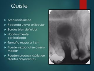 Quiste
 Area radiolúcida
 Redonda u oval unilocular
 Bordes bien definidos
 Habitualmente
corticalizada
 Tamaño mayor a 1 cm
 Pueden expandirse a seno
maxilar
 Pueden producir rizálisis en
dientes adyacentes
 