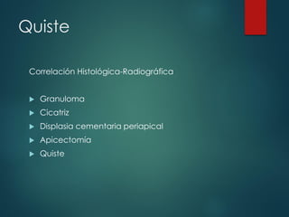 Quiste
Correlación Histológica-Radiográfica
 Granuloma
 Cicatriz
 Displasia cementaria periapical
 Apicectomía
 Quiste
 