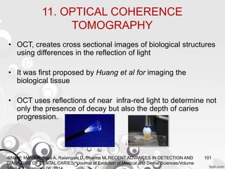 11. OPTICAL COHERENCE
TOMOGRAPHY
• OCT, creates cross sectional images of biological structures
using differences in the reflection of light
• It was first proposed by Huang et al for imaging the
biological tissue
• OCT uses reflections of near infra-red light to determine not
only the presence of decay but also the depth of caries
progression.
101•Mital P, Mehta N, Saini A, Raisingani D, Sharma M. RECENT ADVANCES IN DETECTION AND
DIAGNOSIS OF DENTAL CARIES. Journal of Evolution of Medical and Dental Sciences/Volume
 