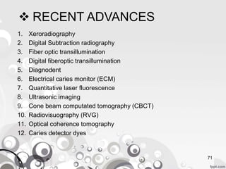  RECENT ADVANCES
1. Xeroradiography
2. Digital Subtraction radiography
3. Fiber optic transillumination
4. Digital fiberoptic transillumination
5. Diagnodent
6. Electrical caries monitor (ECM)
7. Quantitative laser fluorescence
8. Ultrasonic imaging
9. Cone beam computated tomography (CBCT)
10. Radiovisuography (RVG)
11. Optical coherence tomography
12. Caries detector dyes
71
 