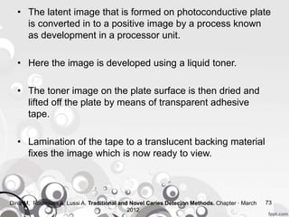 • The latent image that is formed on photoconductive plate
is converted in to a positive image by a process known
as development in a processor unit.
• Here the image is developed using a liquid toner.
• The toner image on the plate surface is then dried and
lifted off the plate by means of transparent adhesive
tape.
• Lamination of the tape to a translucent backing material
fixes the image which is now ready to view.
73Diniz M, Rodrigues A, Lussi A. Traditional and Novel Caries Detecion Methods. Chapter · March
2012
 