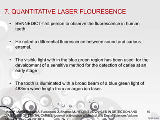 •Mital P, Mehta N, Saini A, Raisingani D, Sharma M. RECENT ADVANCES IN DETECTION AND
DIAGNOSIS OF DENTAL CARIES. Journal of Evolution of Medical and Dental Sciences/Volume
89
• BENNEDICT-first person to observe the fluorescence in human
teeth
• He noted a differential fluorescence between sound and carious
enamel.
• The visible light with in the blue green region has been used for the
development of a sensitive method for the detection of caries at an
early stage
• The tooth is illuminated with a broad beam of a blue green light of
488nm wave length from an argon ion laser.
7. QUANTITATIVE LASER FLOURESENCE
 