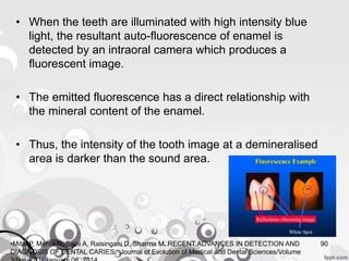 • When the teeth are illuminated with high intensity blue
light, the resultant auto-fluorescence of enamel is
detected by an intraoral camera which produces a
fluorescent image.
• The emitted fluorescence has a direct relationship with
the mineral content of the enamel.
• Thus, the intensity of the tooth image at a demineralised
area is darker than the sound area.
90•Mital P, Mehta N, Saini A, Raisingani D, Sharma M. RECENT ADVANCES IN DETECTION AND
DIAGNOSIS OF DENTAL CARIES. Journal of Evolution of Medical and Dental Sciences/Volume
 