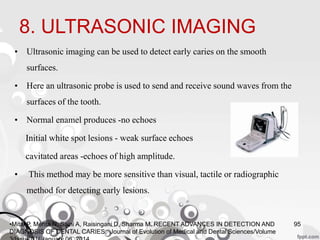 8. ULTRASONIC IMAGING
• Ultrasonic imaging can be used to detect early caries on the smooth
surfaces.
• Here an ultrasonic probe is used to send and receive sound waves from the
surfaces of the tooth.
• Normal enamel produces -no echoes
Initial white spot lesions - weak surface echoes
cavitated areas -echoes of high amplitude.
• This method may be more sensitive than visual, tactile or radiographic
method for detecting early lesions.
95•Mital P, Mehta N, Saini A, Raisingani D, Sharma M. RECENT ADVANCES IN DETECTION AND
DIAGNOSIS OF DENTAL CARIES. Journal of Evolution of Medical and Dental Sciences/Volume
 