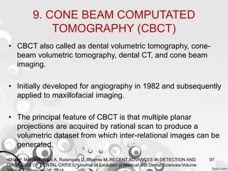 9. CONE BEAM COMPUTATED
TOMOGRAPHY (CBCT)
• CBCT also called as dental volumetric tomography, cone-
beam volumetric tomography, dental CT, and cone beam
imaging.
• Initially developed for angiography in 1982 and subsequently
applied to maxillofacial imaging.
• The principal feature of CBCT is that multiple planar
projections are acquired by rational scan to produce a
volumetric dataset from which inter-relational images can be
generated.
97•Mital P, Mehta N, Saini A, Raisingani D, Sharma M. RECENT ADVANCES IN DETECTION AND
DIAGNOSIS OF DENTAL CARIES. Journal of Evolution of Medical and Dental Sciences/Volume
 