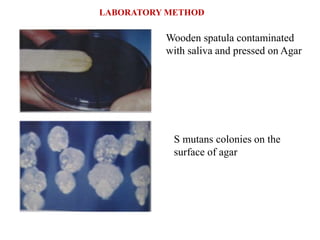 Wooden spatula contaminated
with saliva and pressed on Agar
S mutans colonies on the
surface of agar
LABORATORY METHOD
 