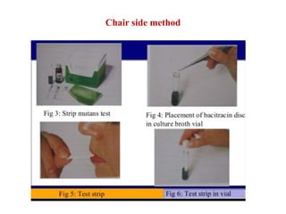 Chair side method
 