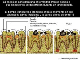 La caries se considera una enfermedad crónica debido a que las lesiones se desarrollan durante un largo periodo.  El tiempo transcurrido promedio entre el momento en que aparece la caries insipiente y la caries clínica es entre 18 y 6 meses.  