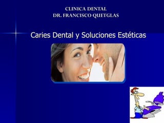 CLINICA DENTAL
      DR. FRANCISCO QUETGLAS


Caries Dental y Soluciones Estéticas
 