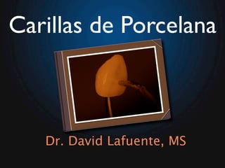 Carillas de Porcelana



   Dr. David Lafuente, MS
 