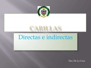 Carillas  Directas e indirectas Dra. De La Cruz 