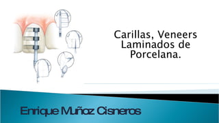 Carillas, Veneers Laminados de Porcelana. Enrique Muñoz Cisneros 