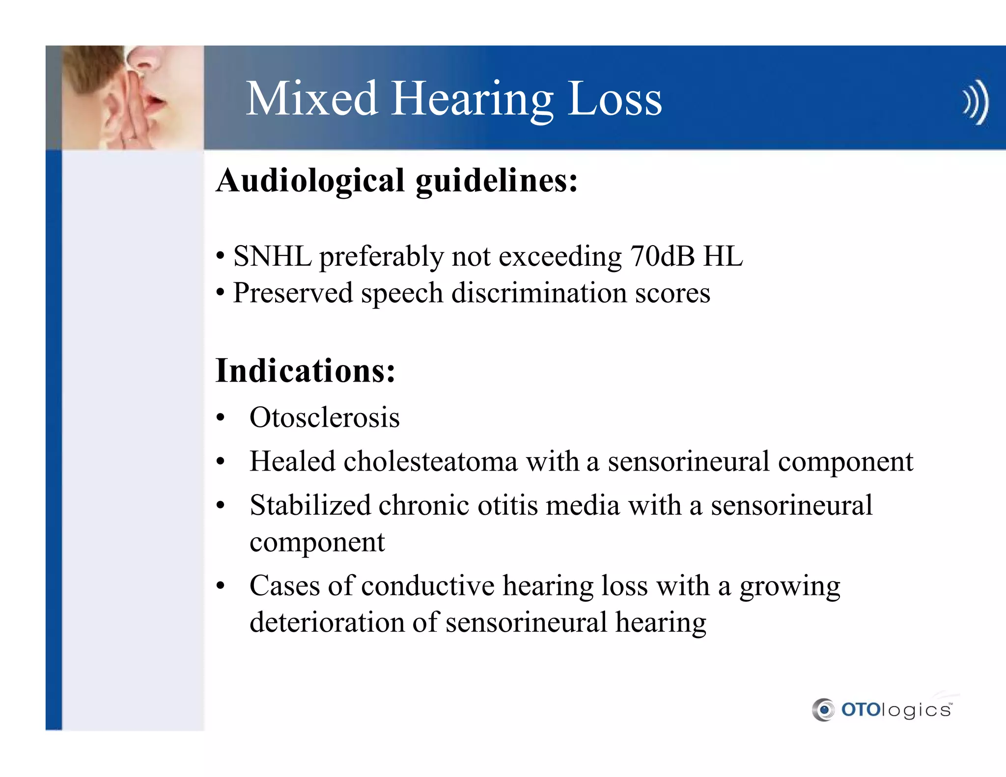 Mixed Hearing Loss
Audiological guidelines:

 SNHL preferably not exceeding 70dB HL
 Preserved speech discrimination scores

Indications:
  Otosclerosis
  Healed cholesteatoma with a sensorineural component
  Stabilized chronic otitis media with a sensorineural
  component
  Cases of conductive hearing loss with a growing
  deterioration of sensorineural hearing
 