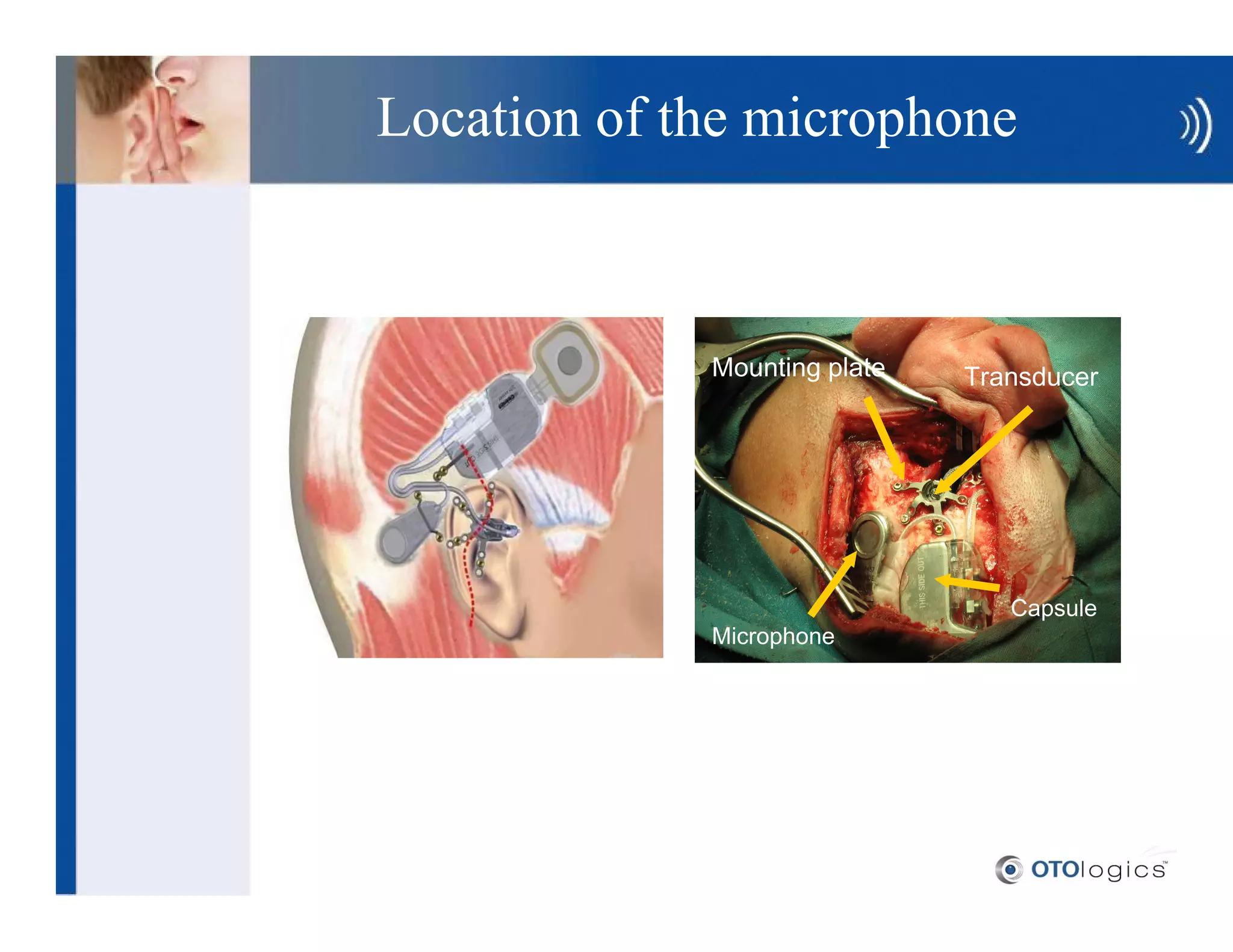 Location of the microphone



             Mounting plate   Transducer




                                 Capsule
             Microphone
 