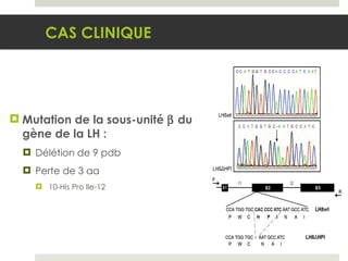 Mutation de la sous-unité    du gène de la LH : Délétion de 9 pdb Perte de 3 aa 10-His Pro Ile-12 CAS CLINIQUE 