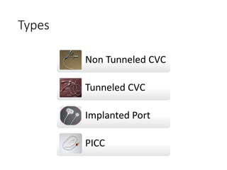 Types
Non Tunneled CVC
Tunneled CVC
Implanted Port
PICC
 