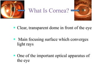 What Is Cornea?<br /><ul><li>Clear, transparent dome in front of the eye
