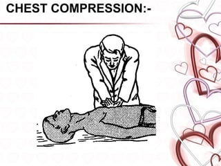 Comprehensive Guide to Cardiopulmonary Resuscitation (CPR) Techniques ...