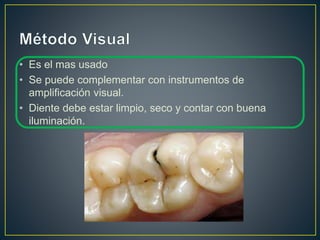 • Es el mas usado
• Se puede complementar con instrumentos de
amplificación visual.
• Diente debe estar limpio, seco y contar con buena
iluminación.
 