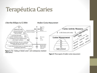 Terapéutica Caries
 