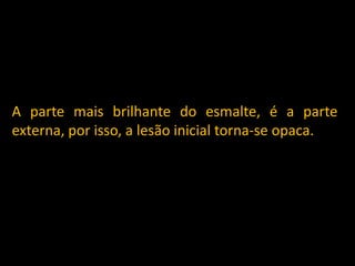 A parte mais brilhante do esmalte, é a parte
externa, por isso, a lesão inicial torna-se opaca.
 