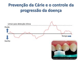 Prevenção da Cárie e o controle da
         progressão da doença

   Limiar para detecção clínica
Perda



                                  Tempo

Ganho
 