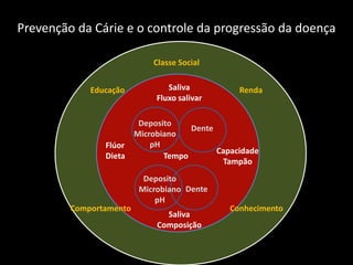 Prevenção da Cárie e o controle da progressão da doença

                            Classe Social


             Educação           Saliva         Renda
                             Fluxo salivar

                       Deposito
                                   Dente
                      Microbiano
                Flúor     pH
                                         Capacidade
                Dieta        Tempo
                                          Tampão
                          Deposito
                         Microbiano Dente
                             pH
         Comportamento                       Conhecimento
                               Saliva
                             Composição
 