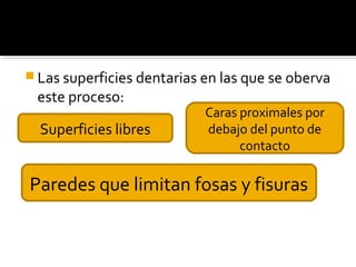  Las superficies dentarias en las que se oberva

este proceso:

Superficies libres

Caras proximales por
debajo del punto de
contacto

Paredes que limitan fosas y fisuras

 