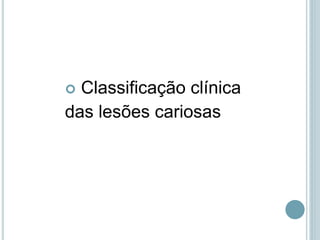  Classificação clínica
das lesões cariosas
 