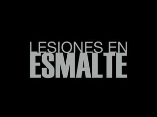 LESIONES EN
ESMALTE
 