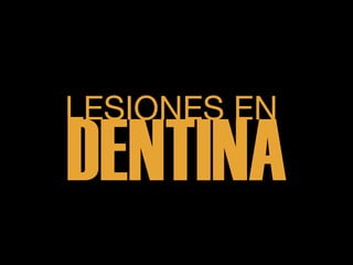 LESIONES EN
DENTINA
 
