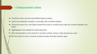 • Interproximal caries
 Proximal caries are the most difficult type to detect.
 Cannot be detected visually or manually with a dental explorer.
 Proximal caries form cervically (toward the roots of a tooth) just under the contact between two
teeth.
 Radiographs are needed for early discovery.
 The disintegration in the enamel in smooth surface caries is also pictures as cone.
 But the base of cone is enamel surface & apex directed towards apex.
 