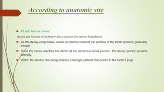 According to anatomic site
 Pit and fissure caries:
the pit and fissures of tooth provide a location for carries formulation.
 As the decay progresses, caries in enamel nearest the surface of the tooth spreads gradually
deeper.
 Once the caries reaches the dentin at the dentino-enamel junction, the decay quickly spreads
laterally.
 Within the dentin, the decay follows a triangle pattern that points to the tooth’s pulp.
 