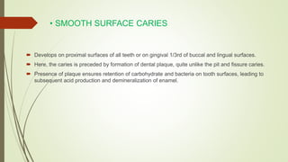 • SMOOTH SURFACE CARIES
 Develops on proximal surfaces of all teeth or on gingival 1/3rd of buccal and lingual surfaces.
 Here, the caries is preceded by formation of dental plaque, quite unlike the pit and fissure caries.
 Presence of plaque ensures retention of carbohydrate and bacteria on tooth surfaces, leading to
subsequent acid production and demineralization of enamel.
 