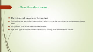 • Smooth surface caries
 Three types of smooth surface caries:
 Proximal caries: also called interproximal caries, form on the smooth surfaces between adjacent
teeth.
 Root caries: form on the root surfaces of teeth.
 The Third type of smooth-surface caries occur on any other smooth tooth surface.
 