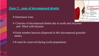 CARIOLOGY | PPT
