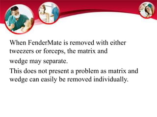 When FenderMate is removed with either 
tweezers or forceps, the matrix and 
wedge may separate. 
This does not present a problem as matrix and 
wedge can easily be removed individually. 
 