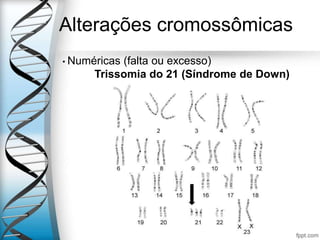 Alterações cromossômicas
• Numéricas (falta ou excesso)
Trissomia do 21 (Síndrome de Down)
 