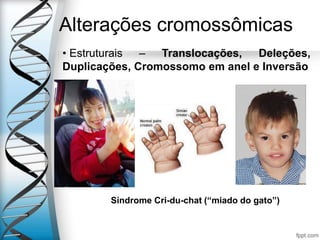 Alterações cromossômicas
• Estruturais – Translocações, Deleções,
Duplicações, Cromossomo em anel e Inversão
Síndrome Cri-du-chat (“miado do gato”)
 